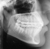 Radiologia Odontológica em Nossa Senhora do Socorro